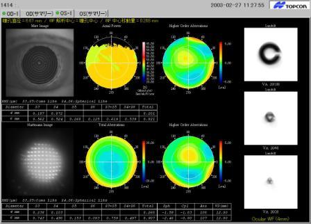 円錐角膜などの黒目(角膜)の凹凸の検査や、だぶって見える(複視)原因の解明、当院で行っているオルソケラトロジーのフォローアップ等に役立っています。 - 診察室(以前の内容)